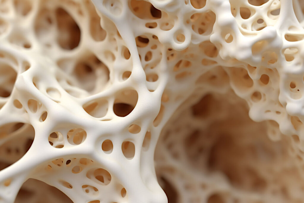 osteoporoza